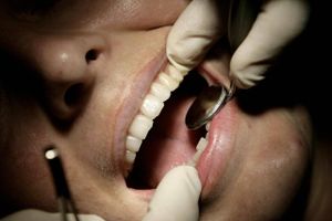 Der rejses nu kritik af den kontrol, der sker, i forbindelse med at tandlæger får ret til at modtage offentlig sygesikring.