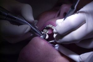 Ingen kan gribe ind over for to tandlægekæder, som imod hensigten har den bestemmende indflydelse i kædens klinikker, fastslår en advokatundersøgelse.