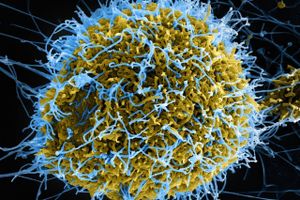 Ebola-viraet – der her ses i en farvelagt skanning, hvor ebola ses som de blå partikler – har skabt krise i Vestafrika. Her hjemme er der dog ikke grund til panik. Foto: CDC/Polaris