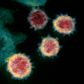 This undated transmission electron microscope image shows SARS-CoV-2, also known as novel coronavirus, the virus that causes COVID-19, isolated from a patient in the U.S. Virus particles are shown emerging from the surface of cells cultured in the lab. The spikes on the outer edge of the virus particles give coronaviruses their name, crown-like. NIAID-RML/Handout via REUTERS. THIS IMAGE HAS BEEN SUPPLIED BY A THIRD PARTY. MANDATORY CREDIT